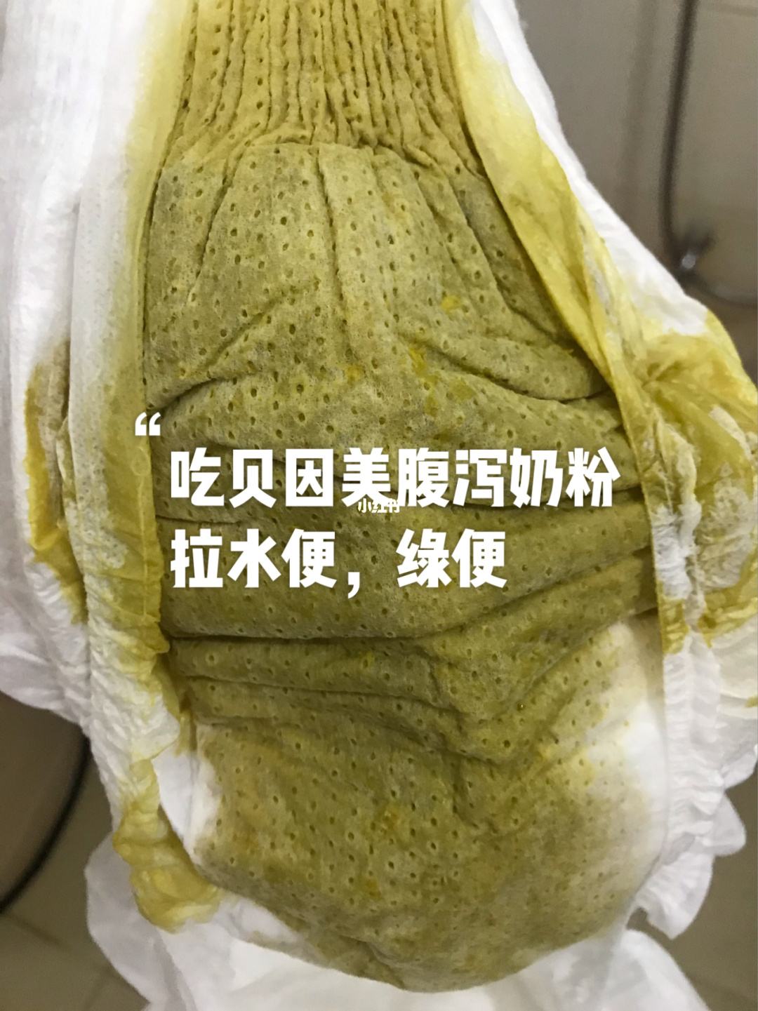 拉绿粑粑用换奶粉吗 吃奶粉拉绿粑粑需要换奶粉吗