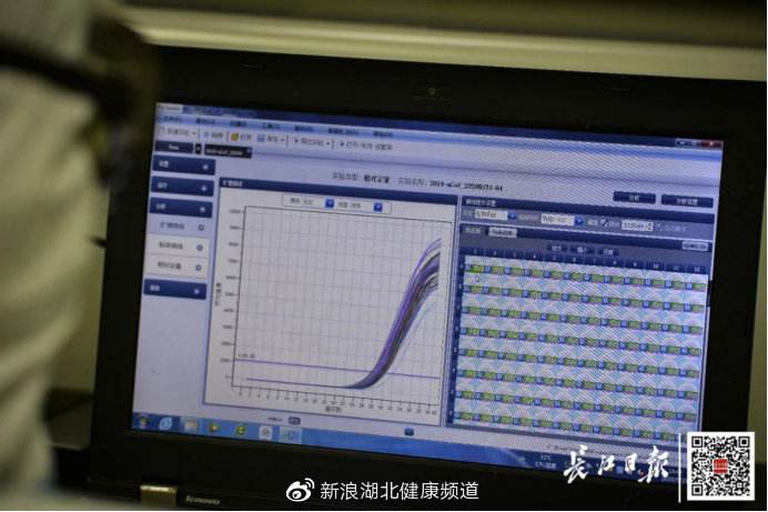 北京新冠病毒检测系统 北京新冠病毒检测机构名单