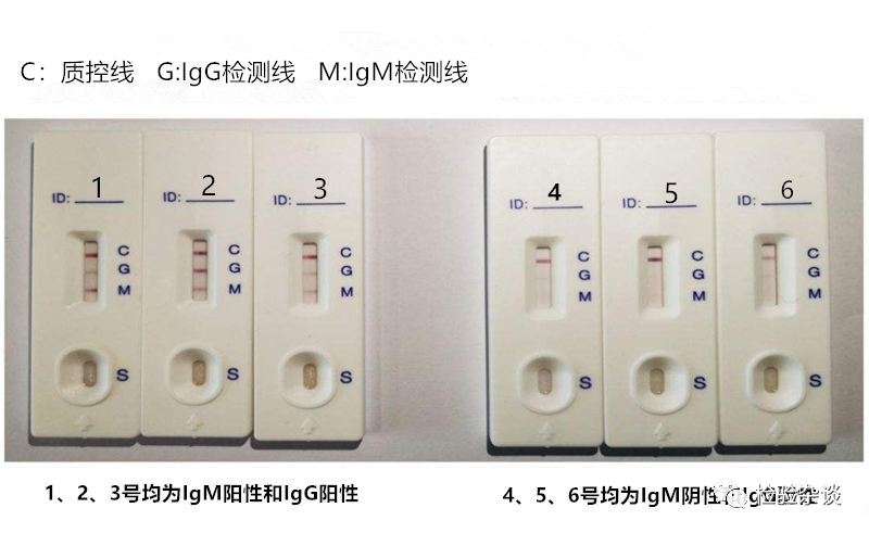 新冠病毒igm抗体偏高 新冠抗体igm高是什么原因