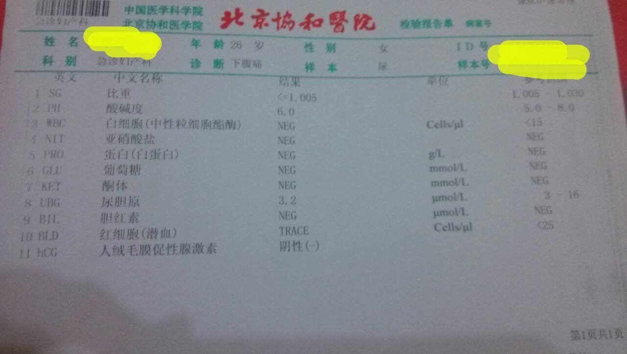 为什么白带是黄绿色的 分泌物黄绿色是什么原因