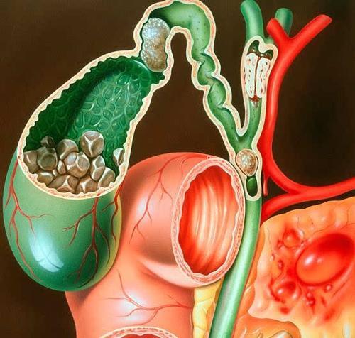 胆囊已切除为什么还痛 胆囊切除手术多长时间能恢复正常